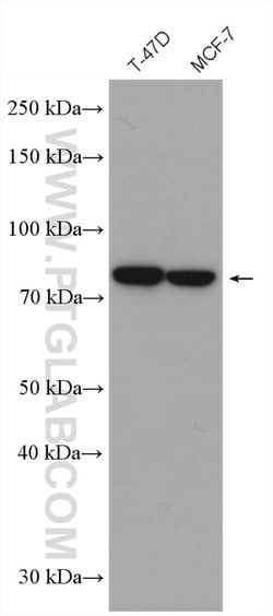 gamma catenin Rabbit anti-Human, Polyclonal, Proteintech 150 &mu;L; Unconjugated:Anticuerpos