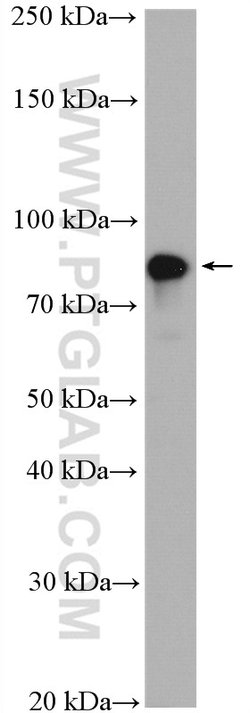 gamma catenin Rabbit anti-Human, Polyclonal, Proteintech 150 &mu;L; Unconjugated:Anticuerpos