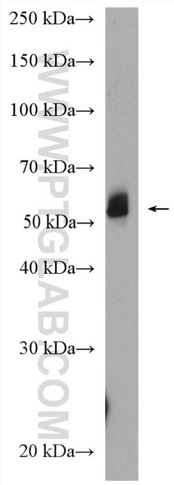 NAP1L4 Rabbit anti-Human, Polyclonal, Proteintech 150 &mu;L | Buy Online | Proteintech Group Inc | Fisher Scientific