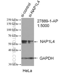 NAP1L4 Rabbit anti-Human, Polyclonal, Proteintech 150 &mu;L | Buy Online | Proteintech Group Inc | Fisher Scientific