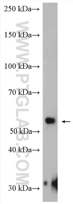 NAP1L4 Rabbit anti-Human, Polyclonal, Proteintech 150 &mu;L | Buy Online | Proteintech Group Inc | Fisher Scientific