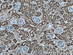 PBLD Rabbit anti-Human, Mouse, Polyclonal, Proteintech:Antibodies:Primary