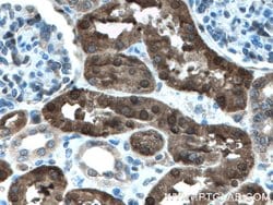 PBLD Rabbit anti-Human, Mouse, Polyclonal, Proteintech:Antibodies:Primary