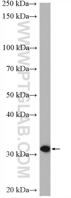 PBLD Rabbit anti-Human, Mouse, Polyclonal, Proteintech:Antibodies:Primary