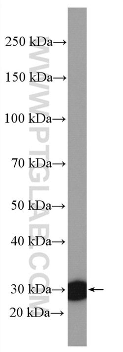 PBLD Rabbit anti-Human, Mouse, Polyclonal, Proteintech:Antibodies:Primary