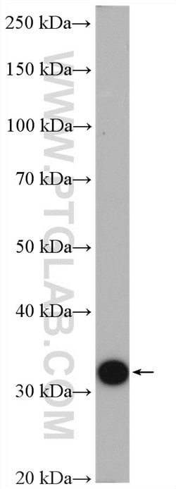 PBLD Rabbit anti-Human, Mouse, Polyclonal, Proteintech:Antibodies:Primary