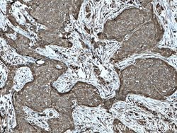 C19orf62 Rabbit anti-Human, Polyclonal, Proteintech 150 &mu;L | Buy Online | Proteintech Group Inc | Fisher Scientific