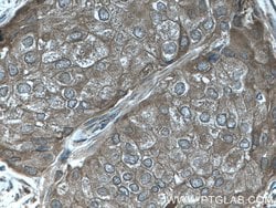 C19orf62 Rabbit anti-Human, Polyclonal, Proteintech 150 &mu;L | Buy Online | Proteintech Group Inc | Fisher Scientific