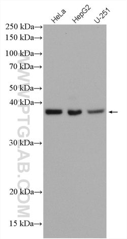 C19orf62 Rabbit anti-Human, Polyclonal, Proteintech 150 &mu;L | Buy Online | Proteintech Group Inc | Fisher Scientific