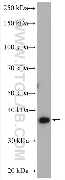 C19orf62 Rabbit anti-Human, Polyclonal, Proteintech 150 &mu;L | Buy Online | Proteintech Group Inc | Fisher Scientific