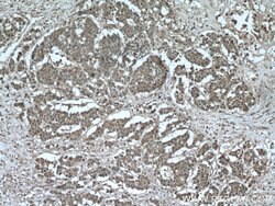 AKAP13 Rabbit anti-Human, Polyclonal, Proteintech 150 &mu;L; Unconjugated:Antibodies,