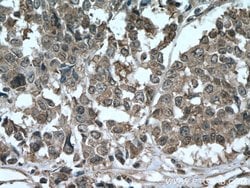 AKAP13 Rabbit anti-Human, Polyclonal, Proteintech 150 &mu;L; Unconjugated:Antibodies,