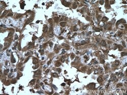 AKAP13 Rabbit anti-Human, Polyclonal, Proteintech 150 &mu;L; Unconjugated:Antibodies,