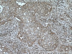 AKAP13 Rabbit anti-Human, Polyclonal, Proteintech 150 &mu;L; Unconjugated:Antibodies,
