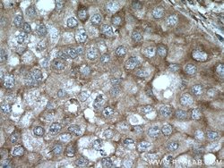 AKAP13 Rabbit anti-Human, Polyclonal, Proteintech 150 &mu;L; Unconjugated:Antibodies,