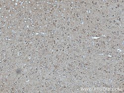 ANK3 Rabbit anti-Human, Mouse, Rat, Polyclonal, Proteintech:Antibodies:Primary