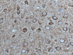 ANK3 Rabbit anti-Human, Mouse, Rat, Polyclonal, Proteintech:Antibodies:Primary
