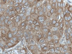 ANK3 Rabbit anti-Human, Mouse, Rat, Polyclonal, Proteintech:Antibodies:Primary