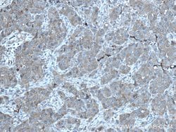 PLSCR3 Rabbit anti-Human, Mouse, Polyclonal, Proteintech 150 &mu;L; Unconjugated:Antibodies,