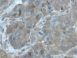 PLSCR3 Rabbit anti-Human, Mouse, Polyclonal, Proteintech 150 &mu;L; Unconjugated:Antibodies,
