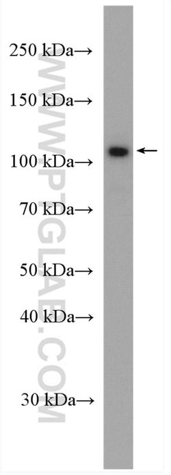 ATP1A3 (middle) Rabbit anti-Human, Polyclonal, Proteintech:Antibodies:Primary
