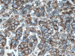 ATP1A3 (middle) Rabbit anti-Human, Polyclonal, Proteintech:Antibodies:Primary