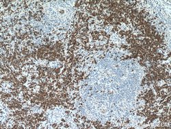 SLC4A1 Rabbit anti-Human, Mouse, Polyclonal, Proteintech 150 &mu;L; Unconjugated:Antibodies,