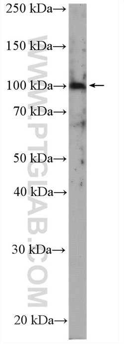 SLC4A1 Rabbit anti-Human, Mouse, Polyclonal, Proteintech 150 &mu;L; Unconjugated:Antibodies,