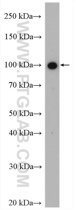 SLC4A1 Rabbit anti-Human, Mouse, Polyclonal, Proteintech 150 &mu;L; Unconjugated:Antibodies,
