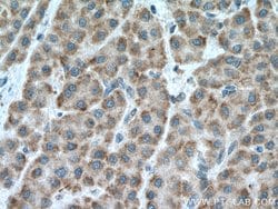 CCDC71 Rabbit anti-Human, Mouse, Rat, Polyclonal, Proteintech 20 &mu;L;