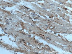 ASK1 Rabbit anti-Human, Mouse, Polyclonal, Proteintech:Antibodies:Primary
