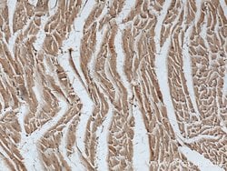 ASK1 Rabbit anti-Human, Mouse, Polyclonal, Proteintech:Antibodies:Primary