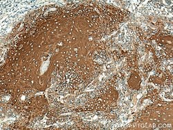 Involucrin Rabbit anti-Human, Polyclonal, ProteinTech 150 &mu;L; Unconjugated:Antibodies,