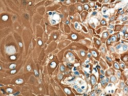 Involucrin Rabbit anti-Human, Polyclonal, ProteinTech 150 &mu;L; Unconjugated:Antibodies,