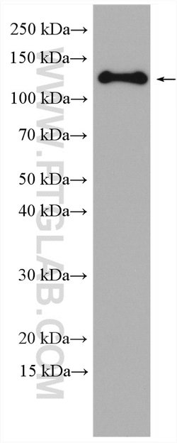 Involucrin Rabbit anti-Human, Polyclonal, ProteinTech 150 &mu;L; Unconjugated:Antibodies,