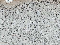 VPS13A Rabbit anti-Human, Mouse, Polyclonal, ProteinTech 150 &mu;L; Unconjugated:Antibodies,