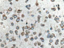 VPS13A Rabbit anti-Human, Mouse, Polyclonal, ProteinTech 150 &mu;L; Unconjugated:Antibodies,
