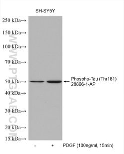 Phospho-Tau (Thr181) Rabbit anti-Human, Mouse, Polyclonal, ProteinTech