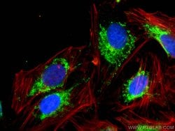 Proteintech Group Inc TRMT10C Rabbit anti-Human, Mouse, Rat, Polyclonal, ProteinTech