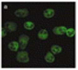 FPR1/2 Monoclonal Antibody (NFPR1), QED Bioscience 100 &mu;g; Unconjugated:Antibodies,