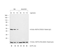 Invitrogen Goat anti-Rabbit IgG (H+L) Secondary Antibody, HRP 200 &mu;L | Buy Online | Invitrogen&trade; | Fisher Scientific