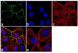 Invitrogen PKP1 Monoclonal Antibody (10B2) 100 &mu;g; Unconjugated:Antibodies,