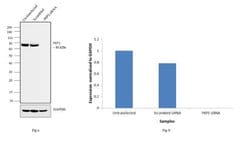 Invitrogen PKP1 Monoclonal Antibody (10B2) 100 &mu;g; Unconjugated:Antibodies,