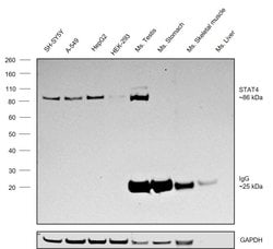 Invitrogen STAT4 Monoclonal Antibody (ST4-5D6) 100 &mu;g; Unconjugated:Antibodies,