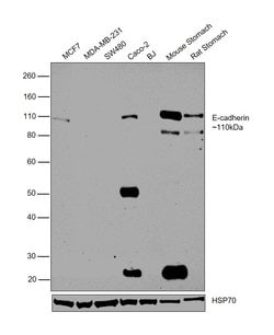 Invitrogen E-cadherin Monoclonal Antibody (4A2C7) 100 &mu;g; Unconjugated:Antibodies,