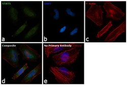 STAT5 alpha/beta Monoclonal Antibody (ST5-8F7), Invitrogen 100 &mu;g; Unconjugated:Antibodies,