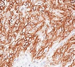 DOG1 Monoclonal Antibody (DOG1.1), QED Bioscience 100 &mu;g | Buy Online | Leinco Technologies Inc | Fisher Scientific