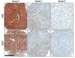 ROR2 Monoclonal Antibody (ROR2 2535-2835), QED Bioscience 100 &mu;g; Unconjugated:Antibodies,