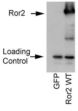 ROR2 Monoclonal Antibody (ROR2 2535-2835), QED Bioscience 100 &mu;g; Unconjugated:Antibodies,