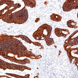 Cytokeratin 18 Monoclonal Antibody (G018.1), QED Bioscience 100 &mu;L;